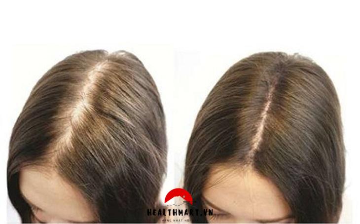 Cải thiện tình trạng tóc rụng và kích thích mọc tóc bằng dầu gội của Nhật