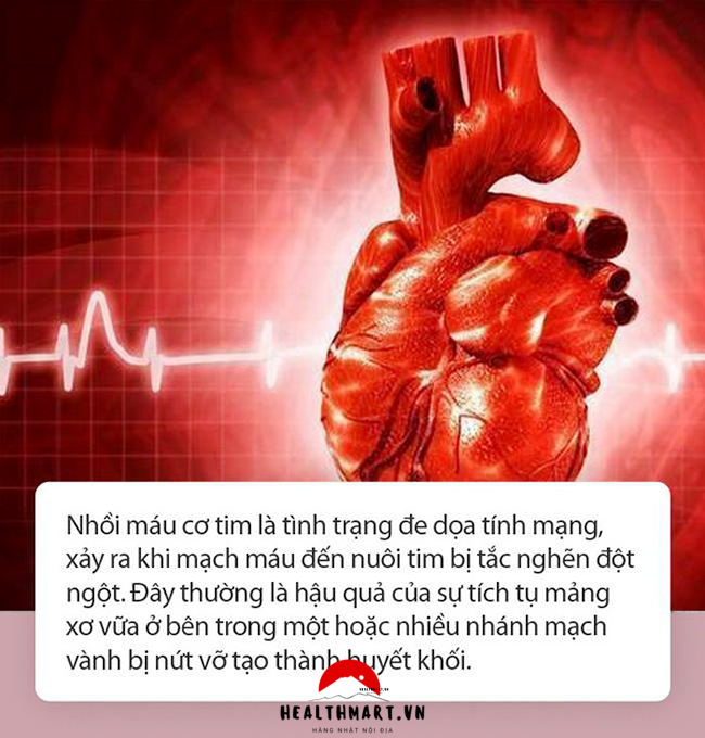 Các dấu hiệu cảnh báo nhồi máu cơ tim cấp, ai có nguy cơ bị nhồi máu cơ tim cấp? 1