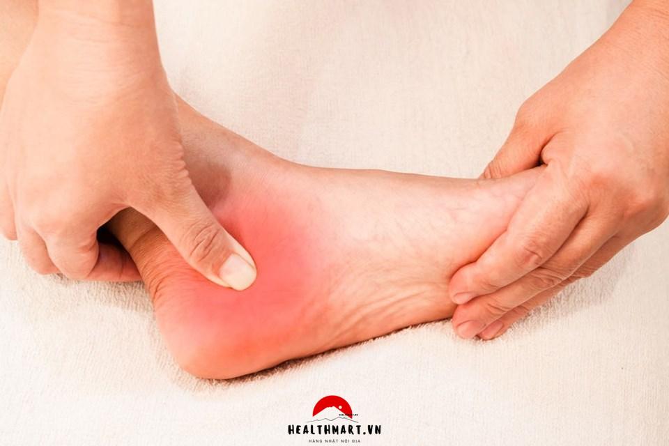 Nguyên nhân gót chân bị nứt nẻ, 11 cách trị nứt gót chân từ nguyên liệu tự nhiên hiệu quả 1