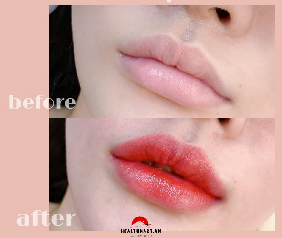 Phun nôi collagen bao nhiêu tiền 2023, bảng giá phun môi tại các spa