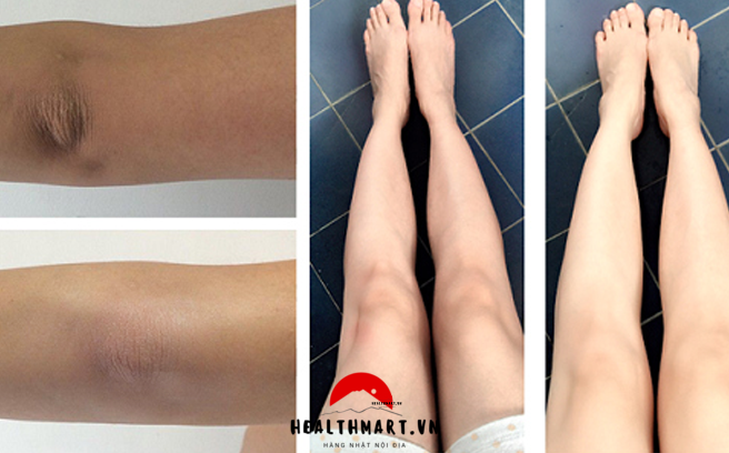 Bảng giá trị thâm đầu gối tại Spa 2023, địa chỉ gợi ý